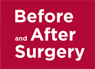 Before and After Surgery Guide